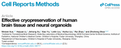 复旦大学邵志成团队开发了人多种神经类器官/脑组织冻存新技术
